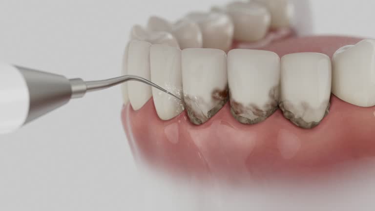 Reliable Emergency Dentist contractor in Pleasanton, TX by Smile Center Dentistry